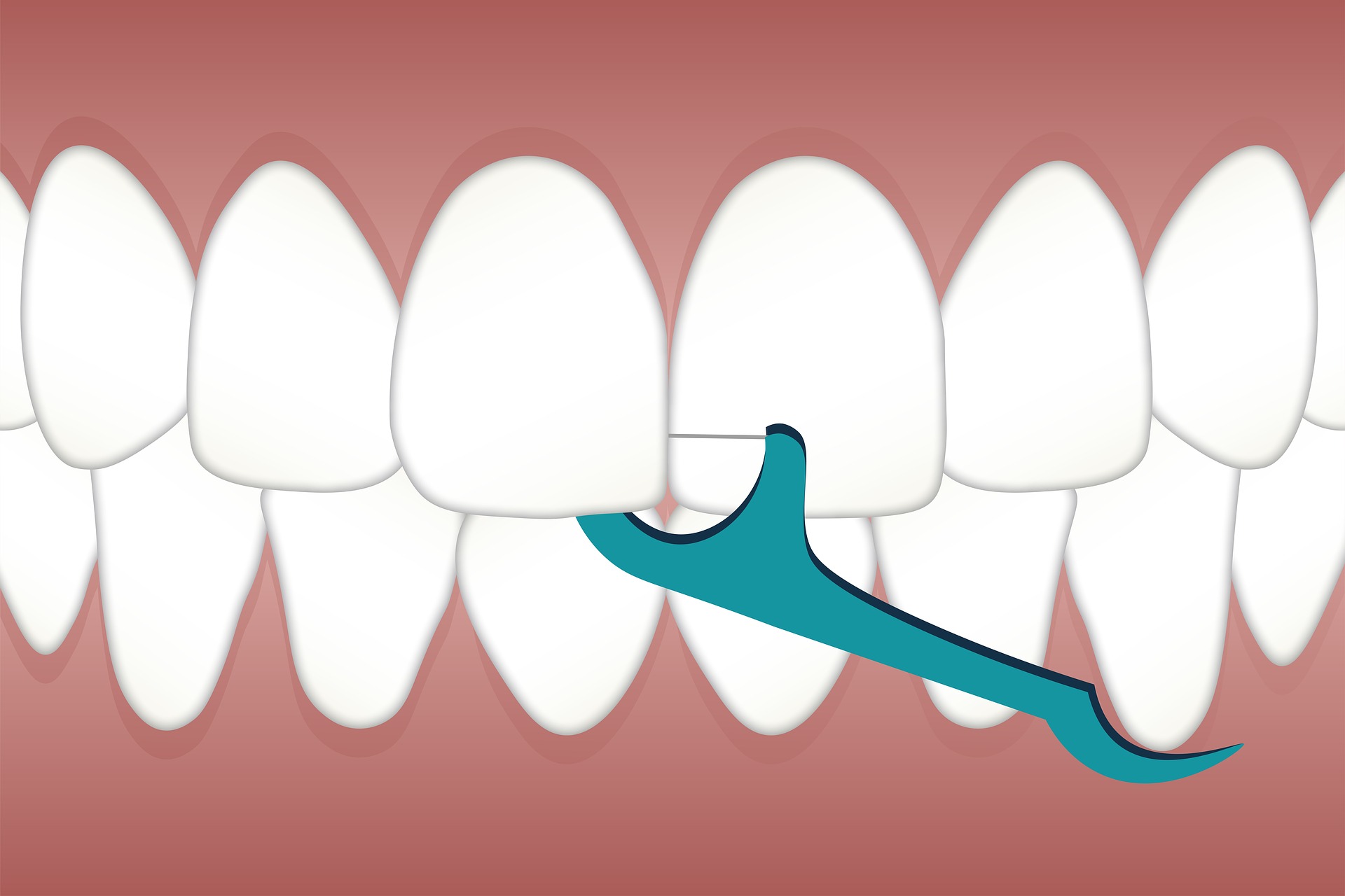 Fio dental: uso diário